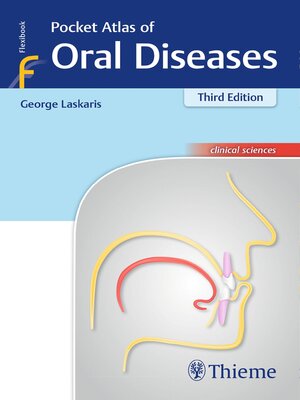 cover image of Pocket Atlas of Oral Diseases